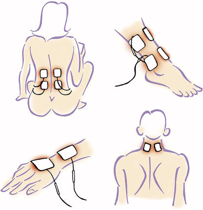 Elle TENS Eletrodos de Reposição
