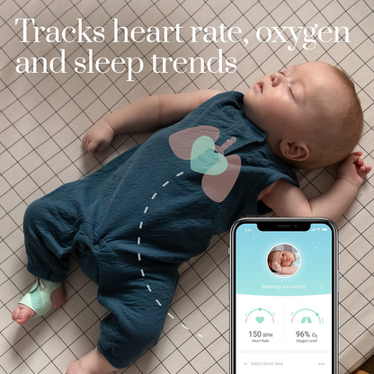 Owlet Smart Sock 3 - Baby Monitor - Rastreie frequência cardíaca, oxigênio e tendências de sono (0 a 18 meses)